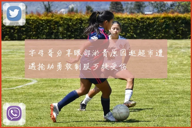 字母哥分享眼部淤青原因逛超市遭遇抢劫勇敢制服歹徒受伤
